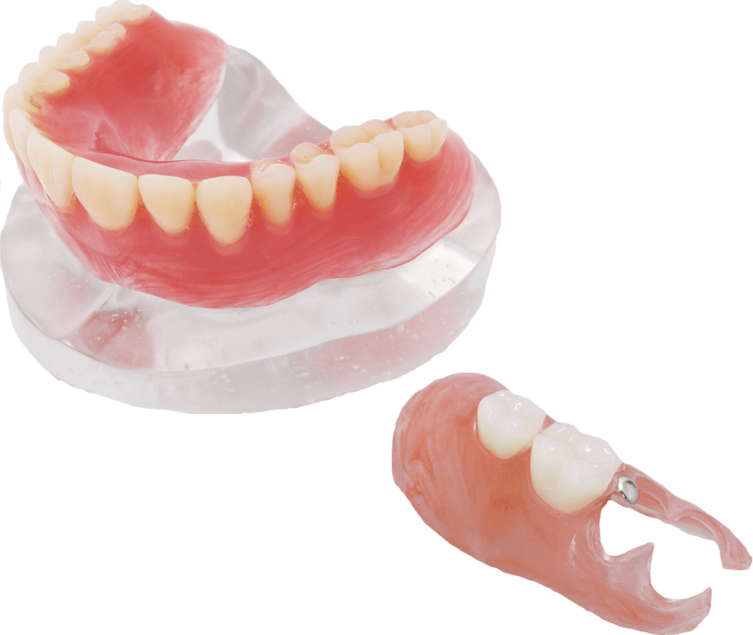 新素材デンタエンプラTUM