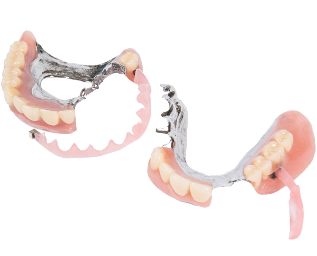 新素材デンタエンプラTUM